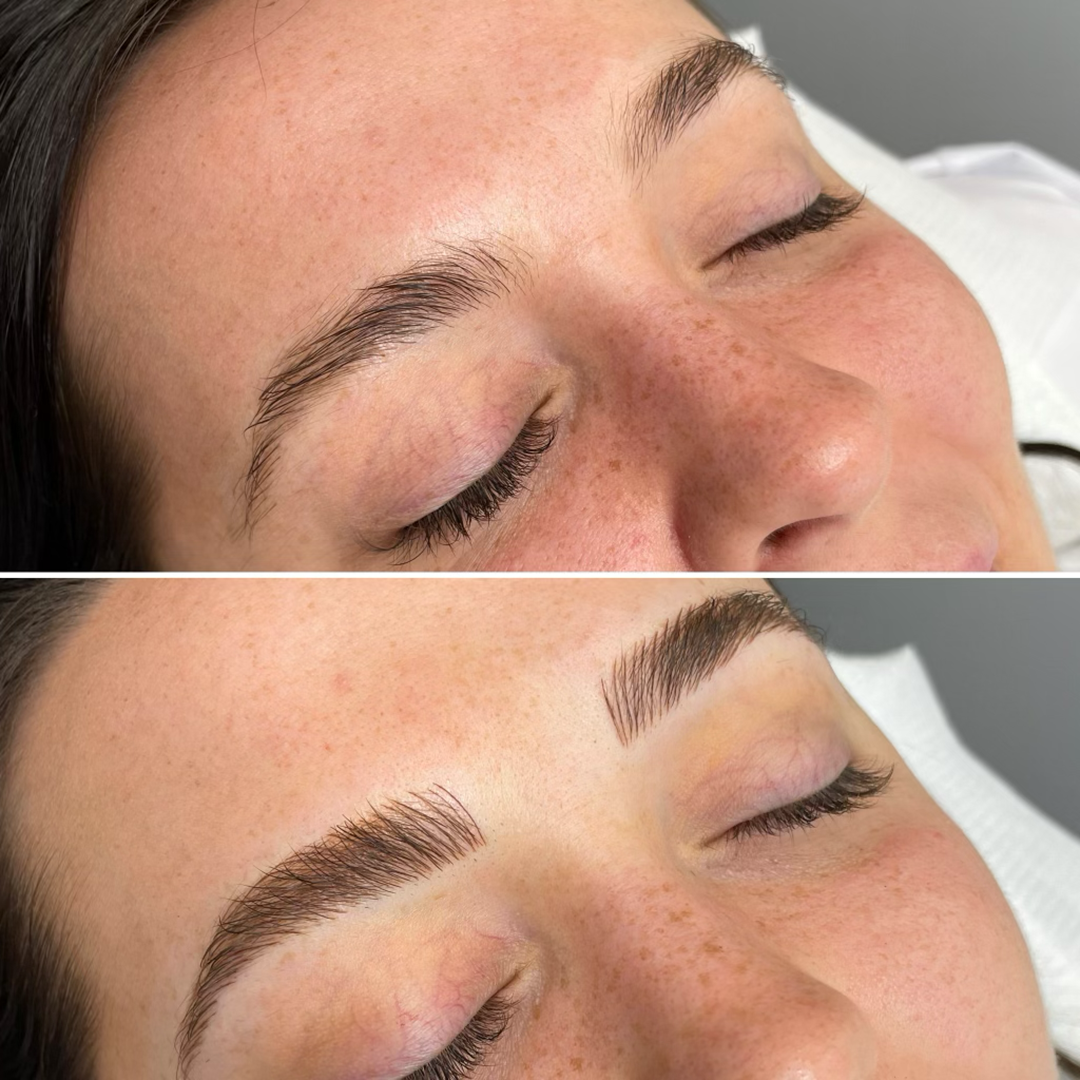 Feather Touch Eyebrow Tattoo | Feather Clinic Brisbane